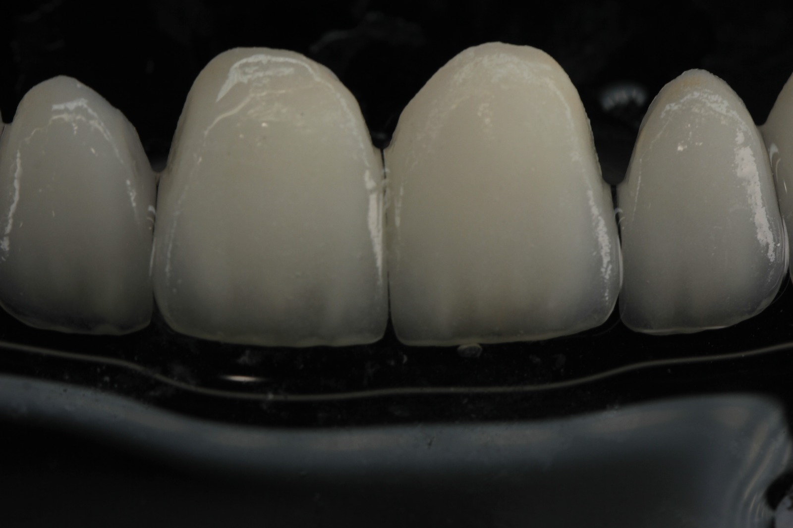 ESPECIALISTAS EN ESTETICA DENTAL Y DISEÑO DE SONRISAS